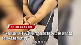 女子患怪病，皮肤可拉伸几厘米如橡皮人