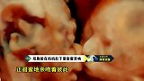 罕见！彩超抓拍到双胞胎在妈妈肚子里甜蜜亲吻