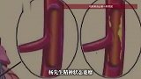 38岁男子喉咙痛，吃了三四天降火药没用，医生一句话点醒：你胸闷吗？