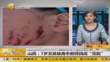 山西7岁女孩被高中教师挠成花脸
