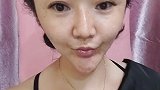 女人千万不要去整容，小姐姐打了满脸的玻尿酸，现在成了这幅模样