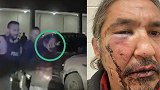 媒体曝原住民酋长遭警察莫名暴打满脸淌血 加总理被“震惊”了