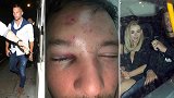 摊上事了！喝水哥酗酒后调戏别人女友 被打的满地是血