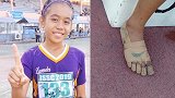 菲律宾女孩没钱买跑鞋用绷带裹脚参赛 拿3块金牌