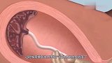 产后手剥胎盘到底有多疼3D动画模拟全过程，看完心疼女人不易