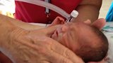 30周早产儿第一次拿开氧气罩，呼吸着自由的空气，感受生命美好