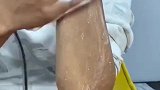你们心心念念的爆红去角质慕斯究竟有没有用！