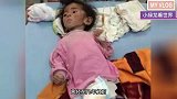 还记得“皮包骨女孩”嘛，女网红主动将她带回家收养，如今怎样？