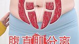 产后最难减的大肚腩，其实是腹直肌分离导致的，产后公认的萨尔曼