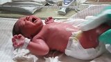 护士给刚出生的婴儿护理，宝宝一直哭不停，好委屈的样子！