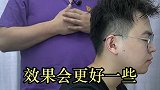 #脱发 #了不起的医生 你知道这种脱发怎么治吗？一起来了解一下