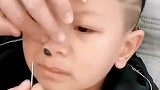萌娃一不小心把玻璃球塞进鼻孔