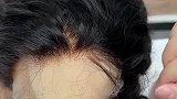 手上长出头发，网友见状愣住了