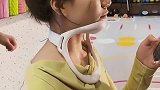 玩手机看电视经常性头前倾，乌龟颈女孩可以试试这个