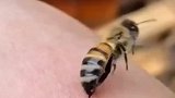 蜜蜂蜇人还会活下来吗