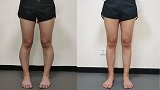 亲测有效！30天弯腿变直，粗腿变细，视觉增长5公分