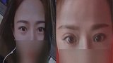 重庆一女子花费9200元 却换来了“菜刀割的”双眼皮