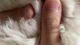 好啦，5天不到这下两个牙齿都没了。。。