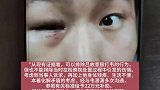 公务员举报“被领导殴打致残”，是非对错需要一个答案