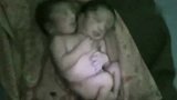 旅游-印度女子诞下双头连体婴 出生30小时就死亡_clip