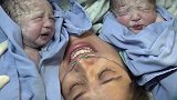 孕妈剖腹产下胖胖双胞胎，两个娃和妈妈脸贴脸，这小表情太可爱了