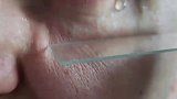 眼泪在显微镜下的样子