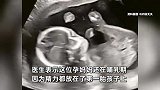 哺乳期妈妈怀孕7个月毫不知情，感觉腹部不适一检查懵了：都以为只是长胖了