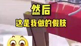儿子给无臂父亲做假肢，让爸爸终于能张开双臂拥抱妈妈