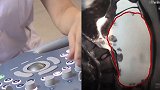 15岁少女卵巢内长恶性肿瘤 医生：很罕见，肿瘤有低龄化趋势