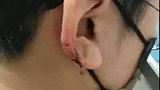 糟心！宁夏一女子理发时耳朵被剪掉一块，理发店赔偿4000元。