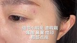 重度瑕疵皮底妆技法四字诀：大瑕疵先 无名指腹 顺肤纹路 内厚外薄 少量多次 轻拍弹飞 细节点压 散粉定实