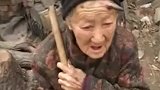头上长“犄角”的人,这到底是什么原因造成的呢?专家这样说