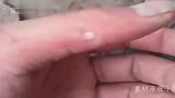 王八咬了手指，一男子为了报仇，竟然喂王八吃芥末