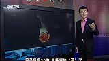 男子吸烟30年 把脉搏抽“没”了 111231 超级新闻场