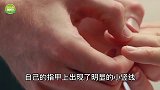 为什么指甲上会长出“竖线”？