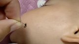 宝宝脸上有一只蚊子，当娘的选择这样做，这波操作我也服了
