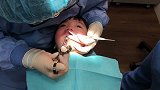 五岁的女儿看牙齿打麻醉针，真的好勇敢！