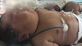 262斤产妇生下巨婴 医生：很罕见 超胖女性怀孕较难