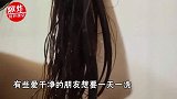 夏季几天洗一次头发最好？洗错了当心加重脱发，堵塞头皮毛囊