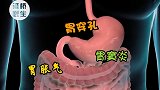 胃一个胃的自述，希望看完你能懂得珍惜自己的身体健康 科普