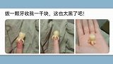 网友拔智齿，拔出一颗“八爪鱼”