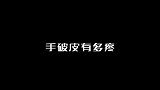 手破皮有多疼，把成龙整无语了，送他去医院吧，不然伤口都愈合了