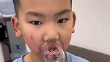 嘴上拔罐，这小子能成事