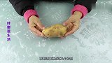 额头上贴一片土豆，解决了许多年轻人的烦恼，看完快试试