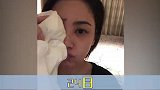 阿娇晒出伤口照，看上去伤口很深，并感谢了朋友及医护人员！