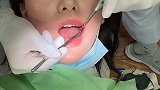 第一次在日本洗牙 被医生说懵了...