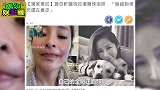 萧亚轩被狗咬脸后首露正脸！伤疤蜿蜒恐怖，自曝脸细胞坏死正养皮