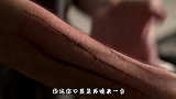 人受伤的伤口是怎么愈合的？3D动画演示全过程，场面太震撼！
