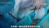 吞咽：有钱人家儿媳妇的快乐，就是三天吃个玻璃球，两天吃个钉子