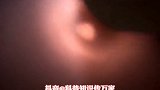 科普 耳蜗是世界上最精密最精致的传感器 涨知识 耳朵